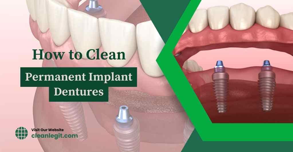 permanent-implant-dentures-how-to-clean-permanent-implant-dentures-